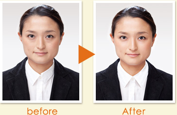 before After